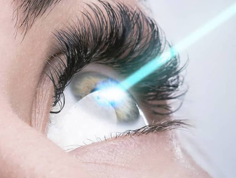 PKR et TransPKR chirurgie laser yeux ophta santé lyon