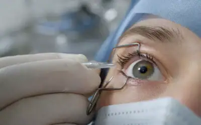 Préparer ses yeux à la chirurgie réfractive : comment traiter une sécheresse oculaire efficacement ?